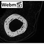 NH MER33 719 Pan troglodytes schweinfurthii metacarpal first right ct stack movie