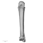 metacarpal third right