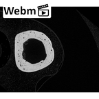 NH MER33 719 Pan troglodytes schweinfurthii metacarpal third right ct stack movie