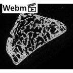 NH MER33 719 Pan troglodytes schweinfurthii trapezoid right ct stack movie