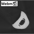 NH MER35 105 Pan troglodytes troglodytes hand phalanx fourth proximal right ct stack movie