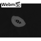 NH MER35 105 Pan troglodytes troglodytes hand phalanx second middle right ct stack movie