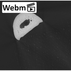 NH MER35 105 Pan troglodytes troglodytes hand phalanx second proximal right ct stack movie