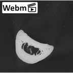 NH MER35 105 Pan troglodytes troglodytes hand phalanx third proximal right ct stack movie