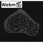 NH MER35 105 Pan troglodytes troglodytes trapezoid right ct stack movie