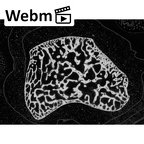 NH MER35 145 Pan troglodytes schweinfurthii capitate right ct stack movie