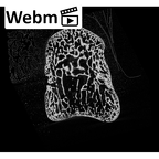 NH MER35 145 Pan troglodytes schweinfurthii hamate right ct stack movie
