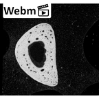 NH MER35 145 Pan troglodytes schweinfurthii hand phalanx fourth proximal right ct stack movie