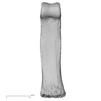 hand phalanx second proximal right
