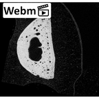 NH MER35 145 Pan troglodytes schweinfurthii hand phalanx second proximal right ct stack movie