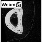 NH MER35 145 Pan troglodytes schweinfurthii hand phalanx third proximal right ct stack movie