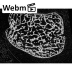 NH MER35 145 Pan troglodytes schweinfurthii lunate right ct stack movie