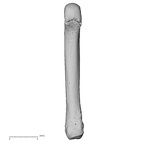 metacarpal fifth right