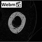 NH MER35 145 Pan troglodytes schweinfurthii metacarpal first right ct stack movie