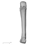 metacarpal fourth right