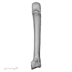 metacarpal second right
