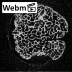 NH MER35 145 Pan troglodytes schweinfurthii metacarpal second right epiphysis ct stack movie