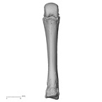 metacarpal third right