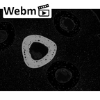 NH MER35 145 Pan troglodytes schweinfurthii metacarpal third right ct stack movie