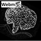 NH MER35 145 Pan troglodytes schweinfurthii metacarpal third right epiphysis ct stack movie