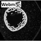 NH MER35 152 Pan troglodytes schweinfurthii metacarpal first left ct stack movie