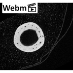 NH MER35 152 Pan troglodytes schweinfurthii metacarpal second left ct stack movie