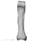 hand phalanx fifth proximal left