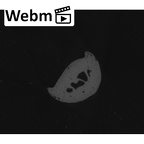 NH MER35 86 Pan troglodytes troglodytes hand phalanx fourth middle left ct stack movie