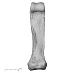 hand phalanx second proximal left