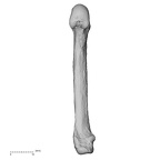 metacarpal fifth left