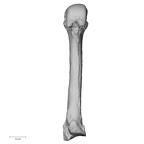 metacarpal third left