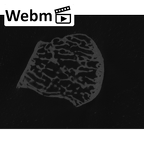 NH MER35 86 Pan troglodytes troglodytes trapezium left ct stack movie