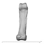 hand phalanx fifth proximal right