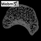NH ZEN7 24 Pan troglodytes troglodytes lunate right ct stack movie