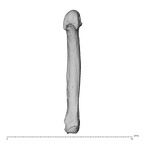 metacarpal fifth right