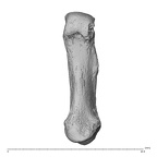 metacarpal first right