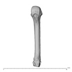 metacarpal fourth right