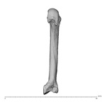 metacarpal second right
