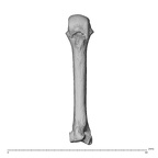metacarpal third right