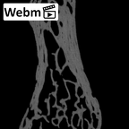 NH ZEN7 24 Pan troglodytes troglodytes pisiform right ct stack movie