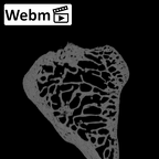 NH ZEN7 24 Pan troglodytes troglodytes trapezium right ct stack movie