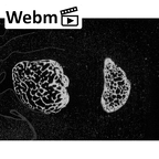 NH MER35 145 Pan troglodytes schweinfurthii ulna right distal epiphysis ct stack movie