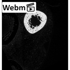 NH MER35 152 Pan troglodytes schweinfurthii radius right ct stack movie