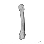 metacarpal fifth right