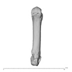 metacarpal fourth right
