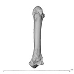 metacarpal second right