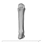metacarpal third right