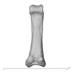 hand phalanx fifth proximal left
