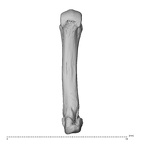 metacarpal fourth left