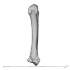 metacarpal second left